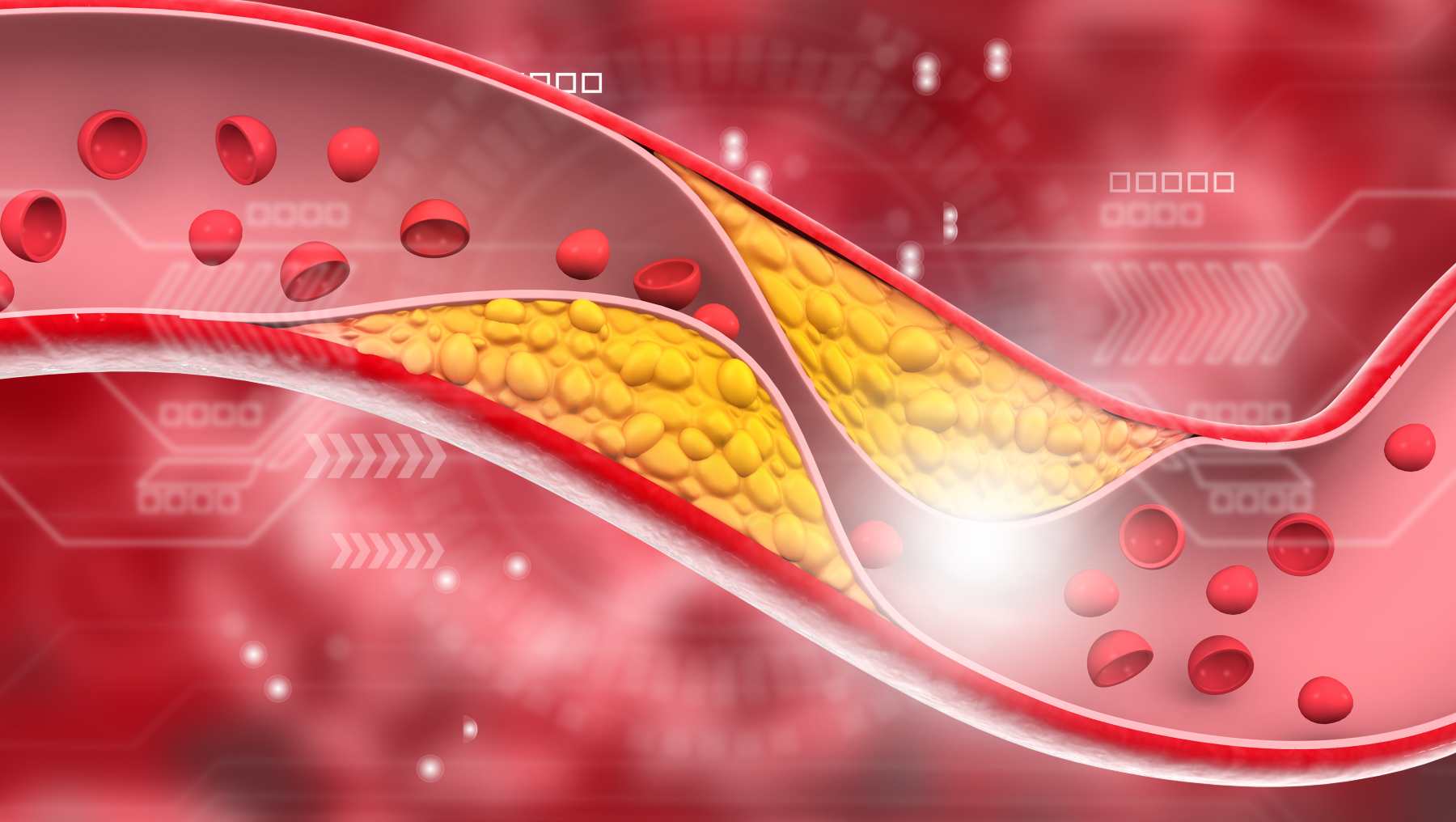 LDL más bajos, estatinas y alternativa natural