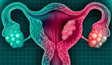 principales recomendaciones para prevenir la enfermedad