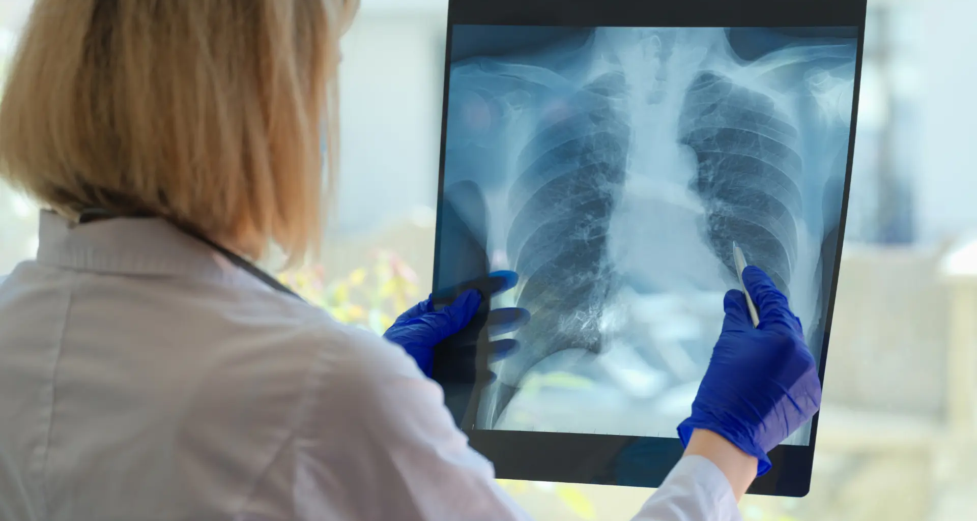 Oncólogos avisan del aumento del cáncer de pulmón en no fumadores y piden más prevención ambiental