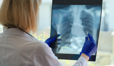 Oncólogos avisan del aumento del cáncer de pulmón en no fumadores y piden más prevención ambiental