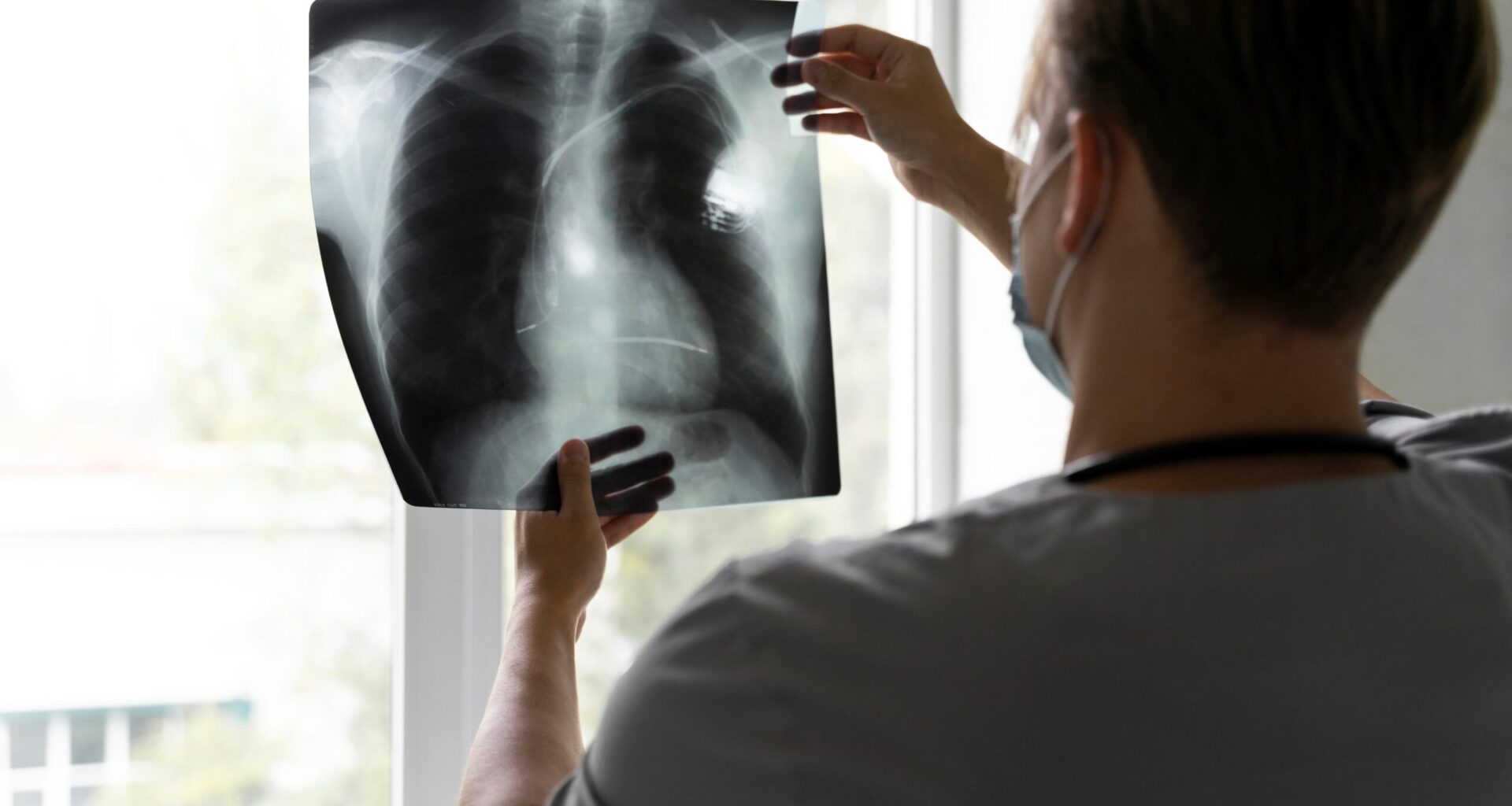 Los oncólogos andaluces destacan el aumento de los casos de cáncer de pulmón en personas no fumadoras y piden reforzar la prevención ambiental, la detección precoz y el acceso a terapias innovadoras en toda Andalucía