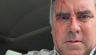 Un candidato presidencial de Perú sobrevive a un atentado tras ser tiroteado en su vehículo