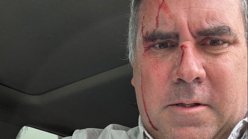 Un candidato presidencial de Perú sobrevive a un atentado tras ser tiroteado en su vehículo