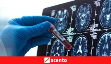 4 avances esperanzadores para la enfermedad de Alzheimer este año