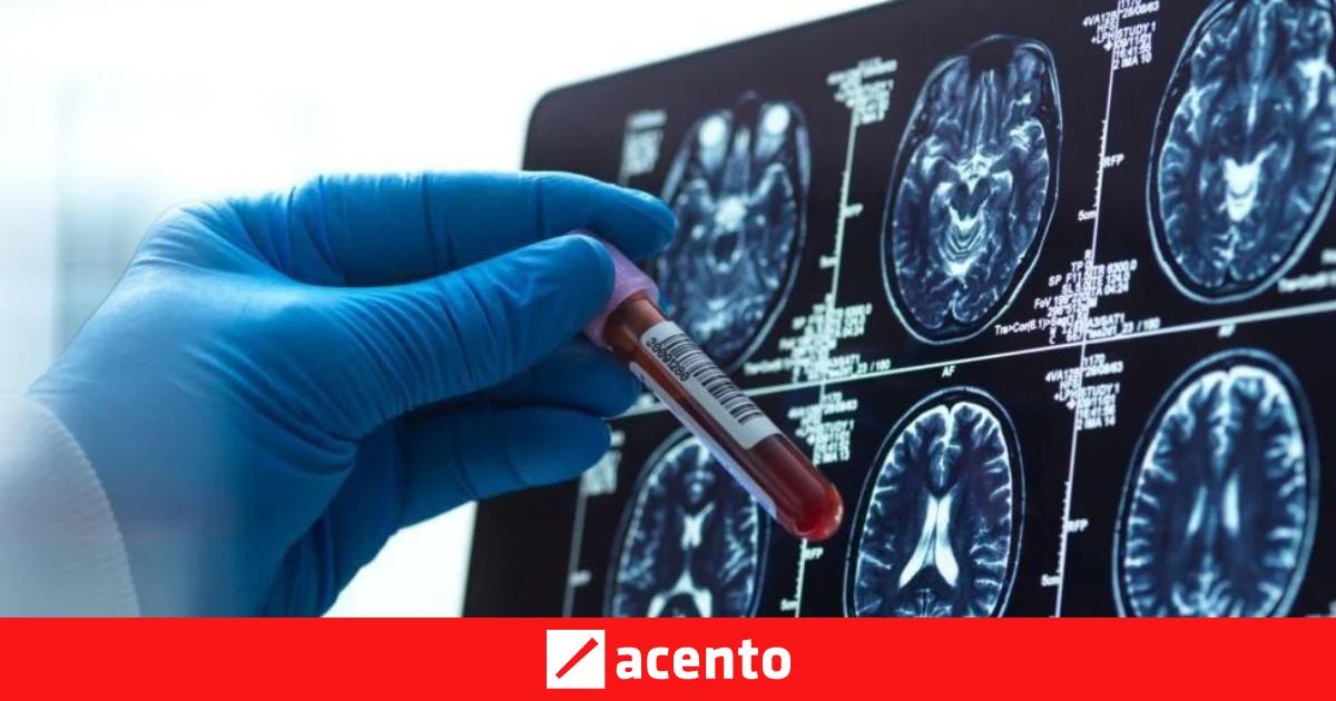 4 avances esperanzadores para la enfermedad de Alzheimer este año