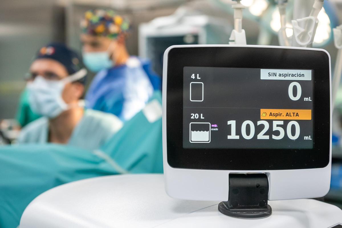 Detalle de uno de los equipos de control durante una cirugía urológica laparoscópica en el Hospital Juaneda Miramar.