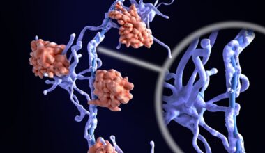 Científicos descubren con IA 2 nuevos subtipos biológicos de esclerosis múltiple