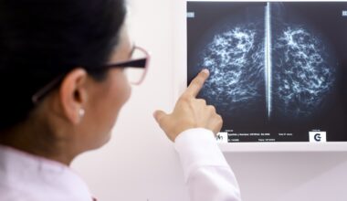 Cáncer de mama: cómo se altera el reloj biológico del organismo antes de que el tumor sea detectable