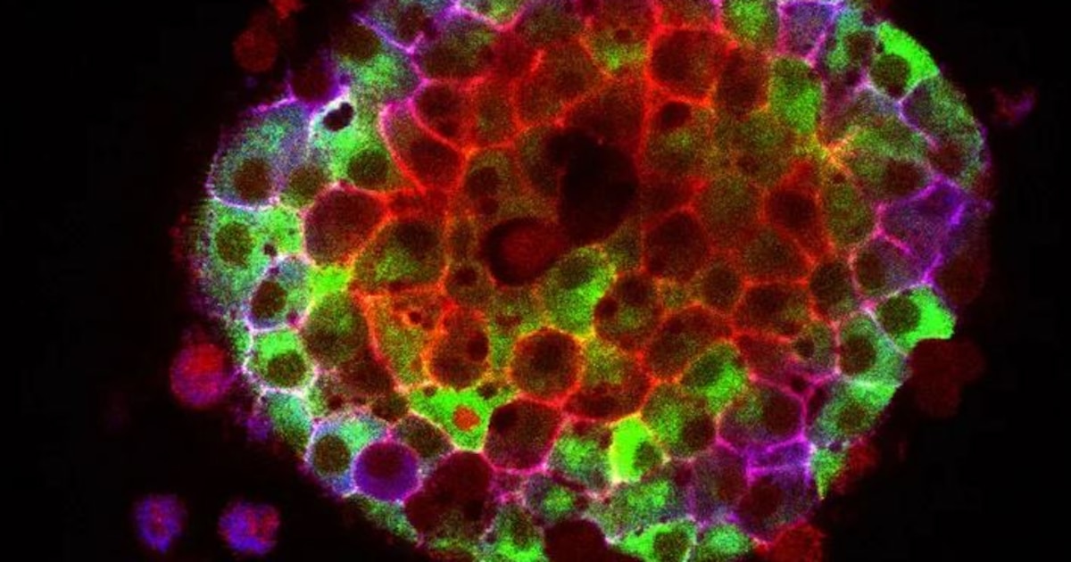 Una pequeña molécula intestinal podría reducir el riesgo de diabetes tipo 2