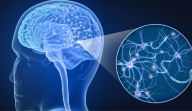 Detectan dos nuevos subtipos de esclerosis múltiple gracias a un análisis con inteligencia artificial