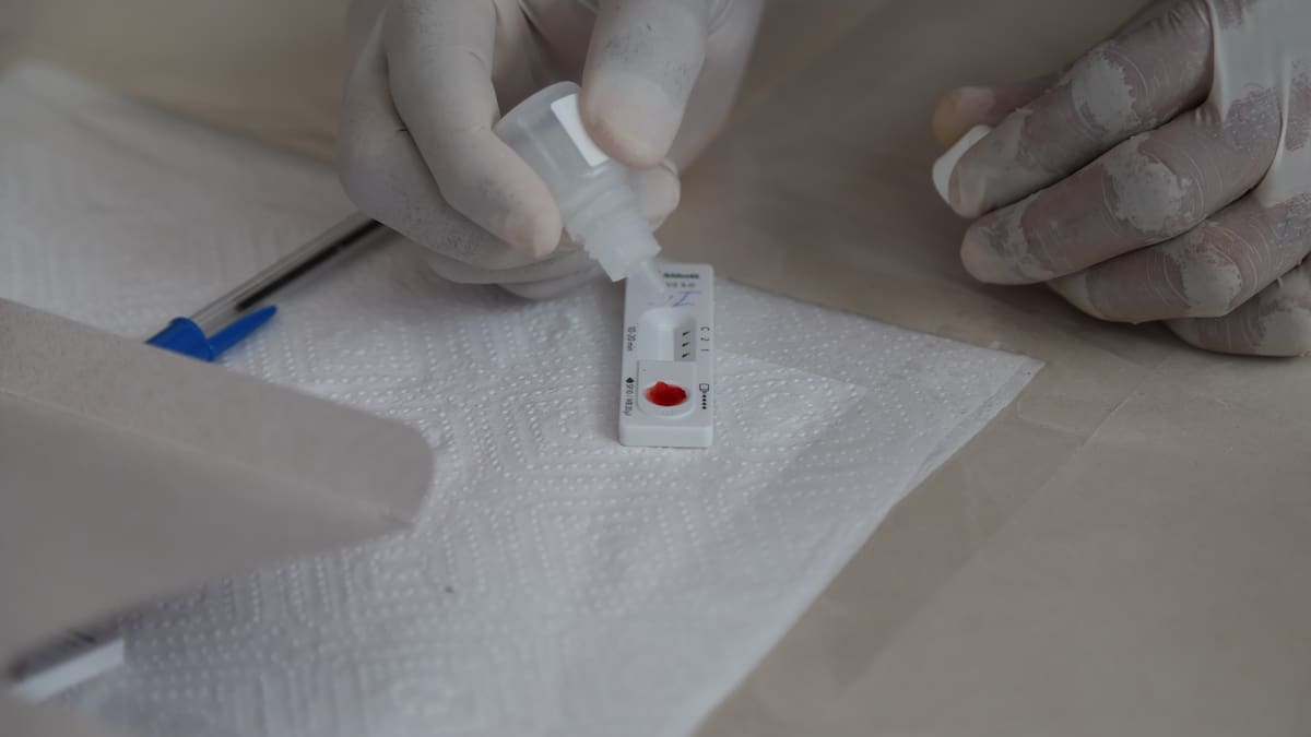 Castilla-La Mancha es de las comunidades de España que menos casos de SIDA registra | SER Ciudad Real