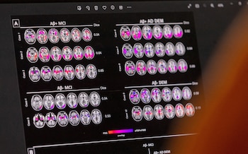 El estudio utilizó la técnica