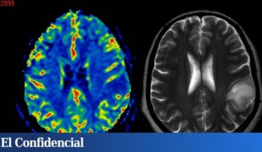 El secreto de un cerebro joven podría estar en los músculos