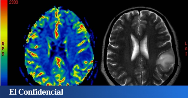 El secreto de un cerebro joven podría estar en los músculos