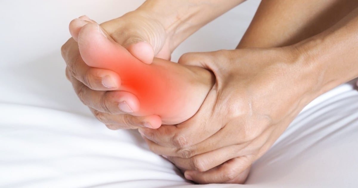 Qué es la gota y por qué están aumentando los casos alrededor del mundo