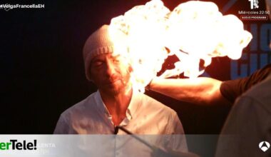 "Me he quemado un poquito"