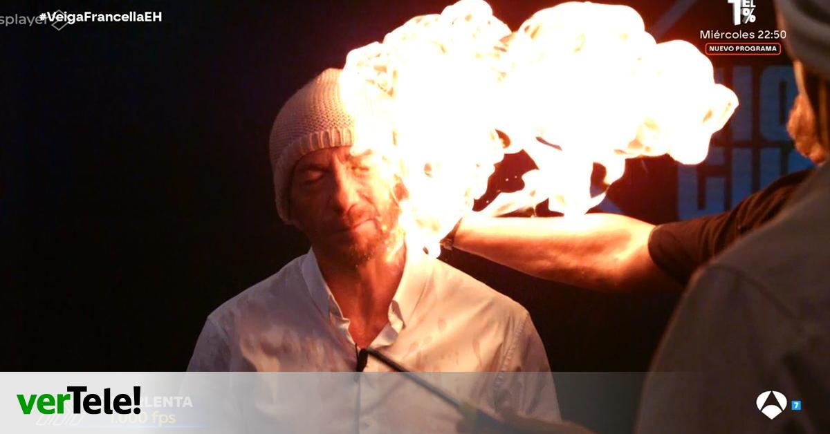 "Me he quemado un poquito"