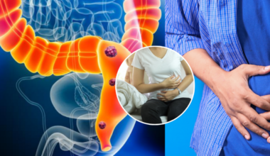 los médicos derrumban los mitos