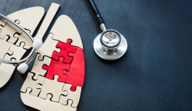 El tratamiento podría alargar la vida entre uno y cuatro años.