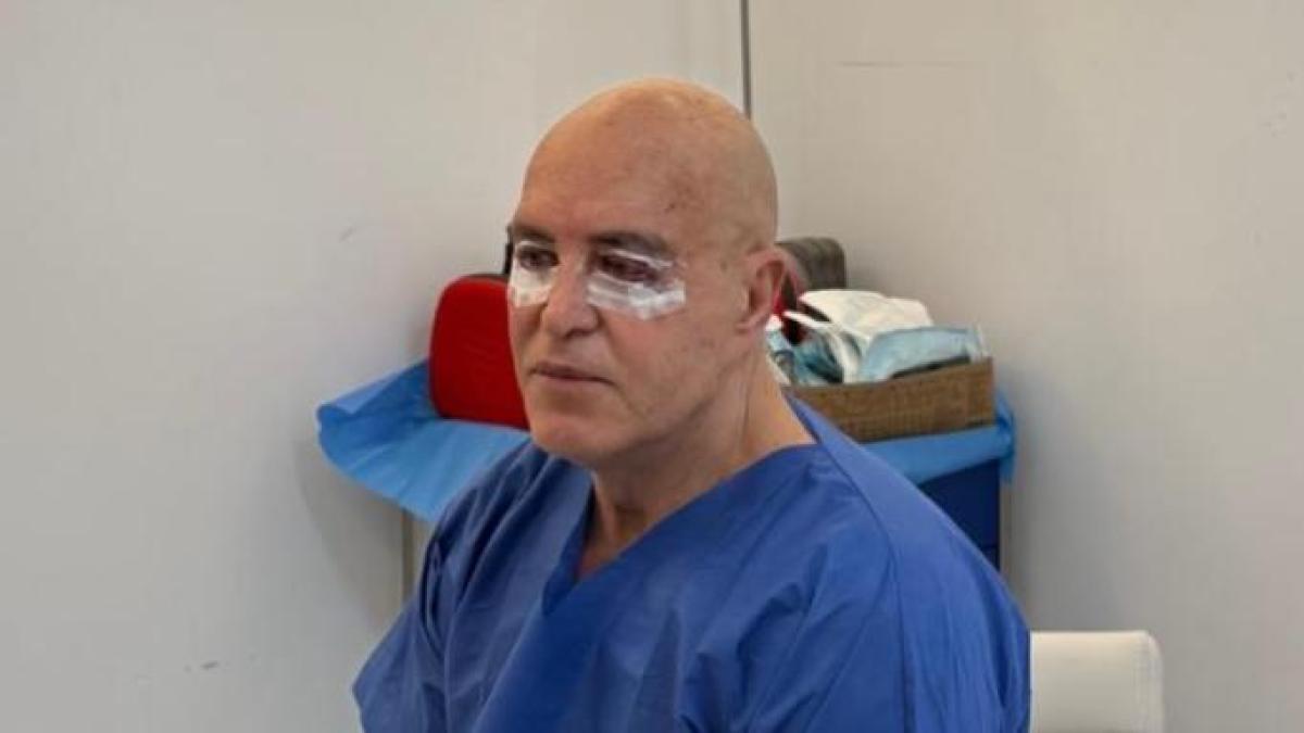 Kiko Matamoros se somete a una nueva intervención estética en la cara: este es el resultado