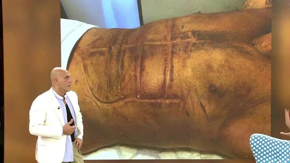 Kiko Matamoros después de otra intervención