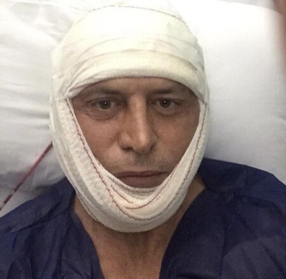 Kiko Matamoros después de otra intervención