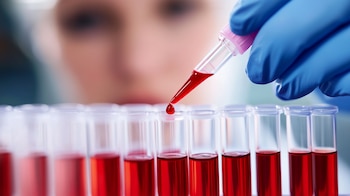 El análisis integral de sangre