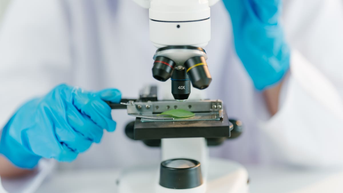 Logran curar el VIH a un paciente alemán con un trasplante de células madre | Ciencia y tecnología