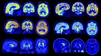 El escáner PET NeuroEXPLORER de