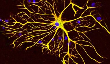 Un fármaco experimental detiene el alzhéimer antes de que aparezcan los síntomas