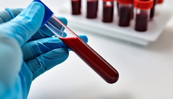 El estudio advierte que el