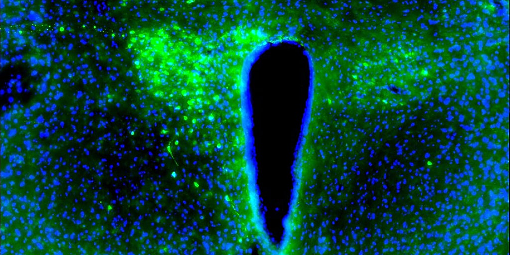 El cáncer de mama desincroniza las neuronas por la noche para seguir avanzando