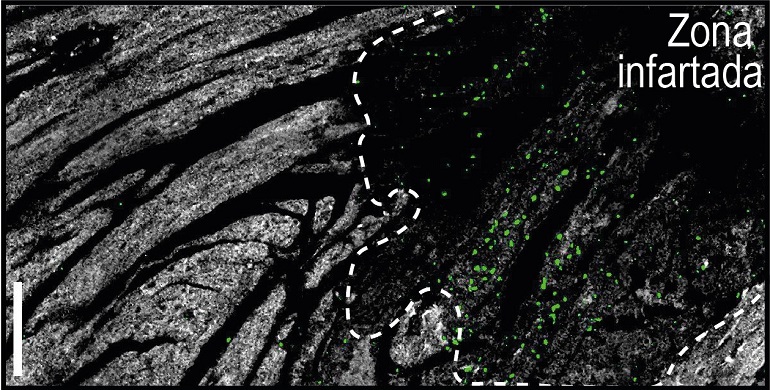 Los neutr&oacute;filos son menos agresivos por la noche, lo que explica que los infartos nocturnos sean menos da&ntilde;inos&nbsp;