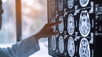 Científicos de Stanford analizaron datos