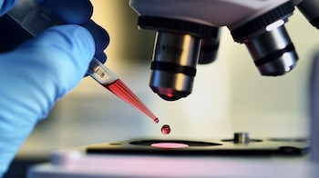 La medición de Lp(a) no