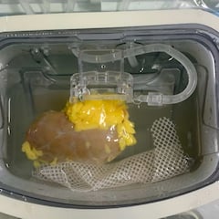 Científicos chinos dan un nuevo paso y crean un riñón “universal” compatible con cualquier tipo de sangre