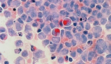 Foto: National-cancer-institute-mbL91Lg56zc-unsplash