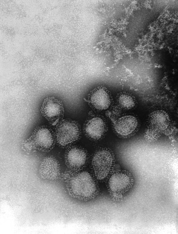 Vista del virus de la