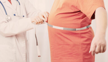 "La alta prevalencia de pacientes con obesidad en el mundo hace imposible financiar el tratamiento de inicio a todos"