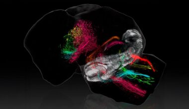 Cartograf&iacute;an c&oacute;mo el cerebelo construye sus conexiones con el resto del cerebro durante el desarrollo temprano