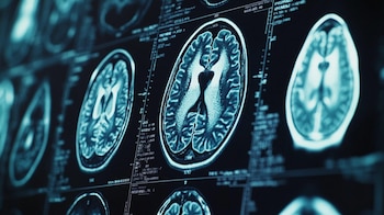 Los nuevos hallazgos desafían la