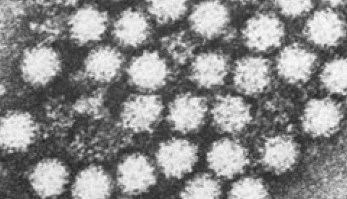 norovirus