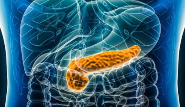 Cáncer de páncreas: una inmunoterapia universal podría cambiar el tratamiento de la enfermedad