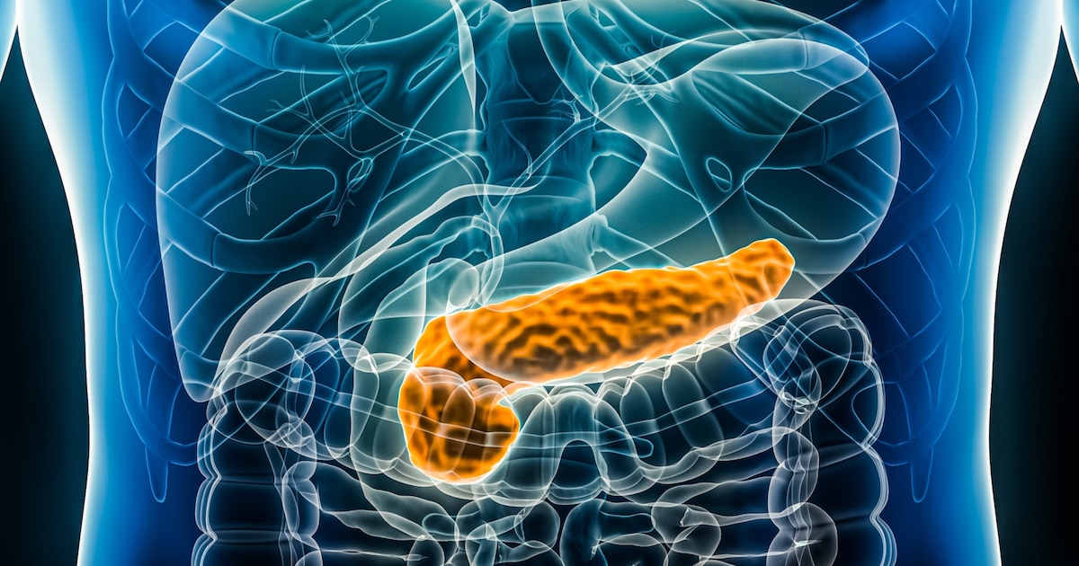 Cáncer de páncreas: una inmunoterapia universal podría cambiar el tratamiento de la enfermedad