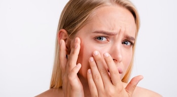 La exposición a rayos UV