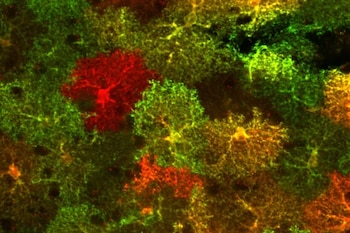 Los astrocitos, células cerebrales antes