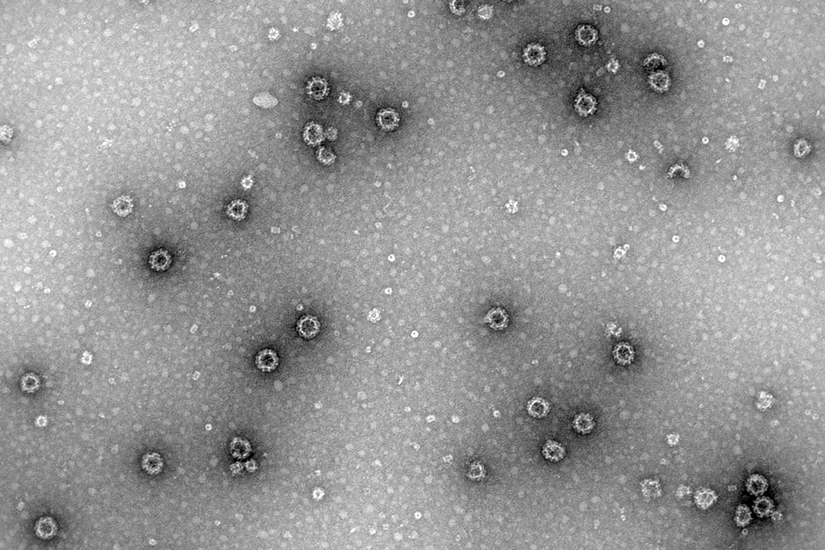 Identifican el papel de una enzima clave en la infección por rotavirus y norovirus, principales causantes de gastroenteritis aguda