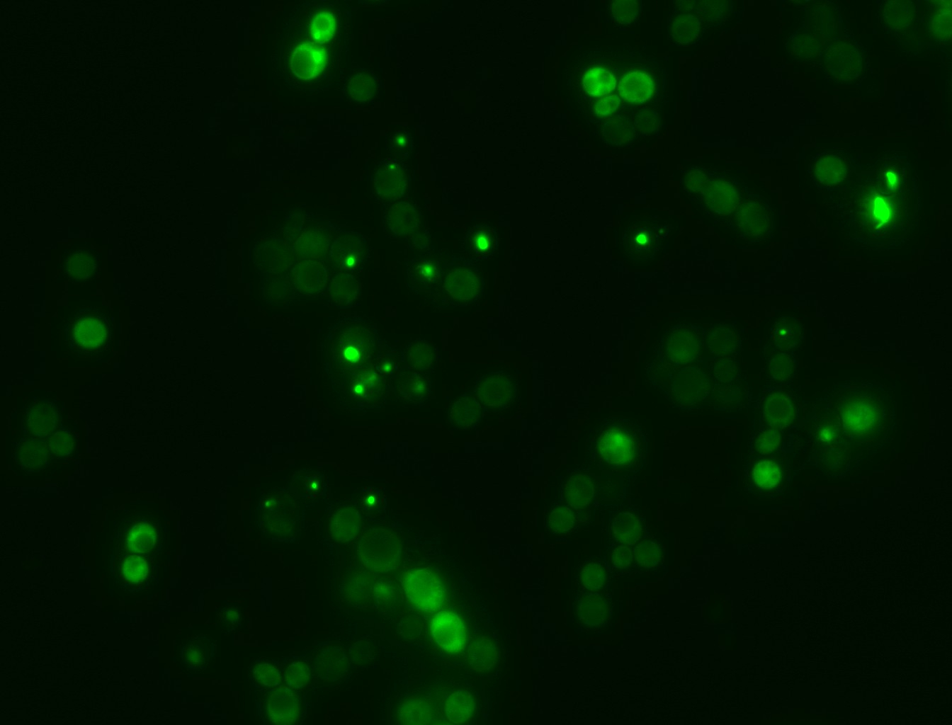 Una IA española descifra el lenguaje secreto de la agregación de proteínas