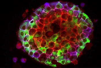  La TMA, producida por