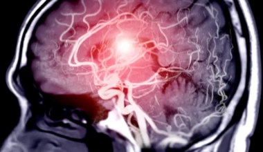 Un estudio detectó un gen que podría mejorar la atención y reducir el “ruido” cerebral en personas con trastornos psicológicos – La 100